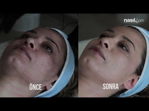 download lagu mp3 mp4 Dermaten, download mp3 Dermaten free download, download mp3 Dermaten