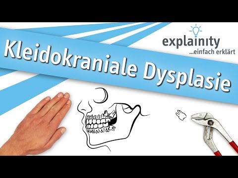 Kleidokraniale Dysplasie – einfach erklärt