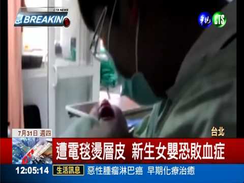 電毯燙嬰動刀成功 爸媽暫心安