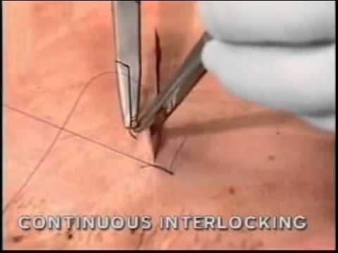 شرح continous interlocking معتمد - منصة معارف