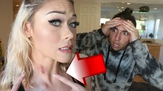 HICKEY PRANK ON BOYFRIEND!! (GONE WRONG)