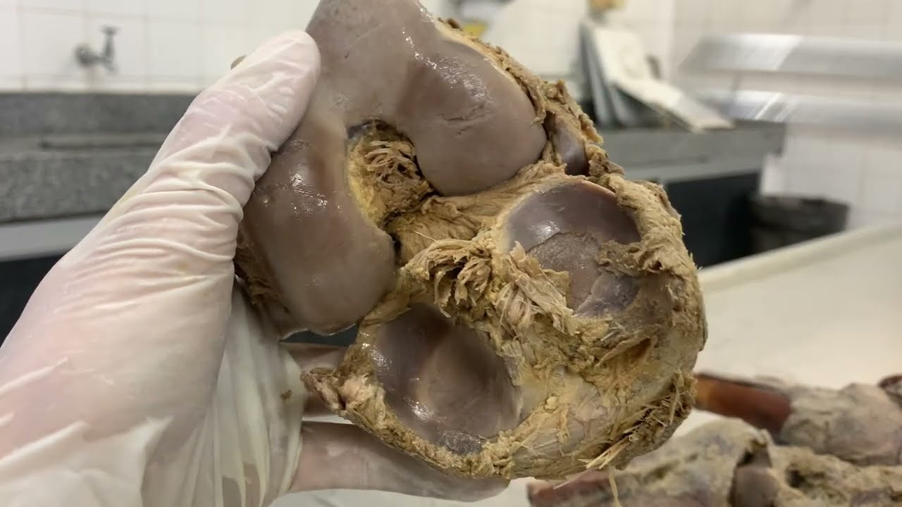 Articulação sinovial humana real