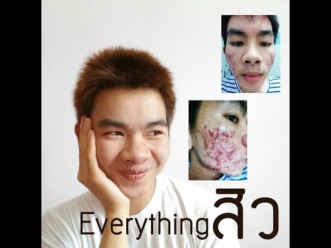 กว่าแรงถั่วที่มีประโยชน์ ผู้หญิงที่ทำให้เชื้อโรค