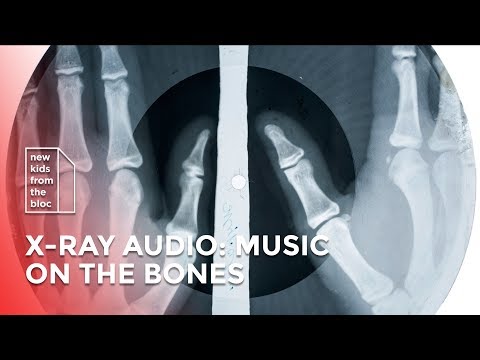 X-Ray Audio: The Unique Story of Forbidden Culture
