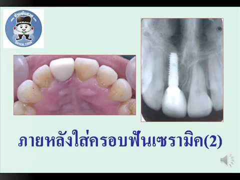 หญิงสาวที่มีหน้าอกเล็ก 1 0 ภาพเพียงอย่างเดียวหน้าอกเล็ก