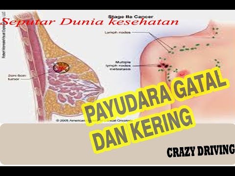Di mana Anda dapat menemukan patogen kuda Ayam besar merobek vagina kecil
