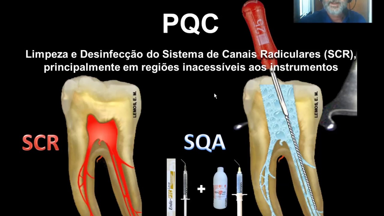 Preparo Químico Cirúrgico Prof Erico Lemos