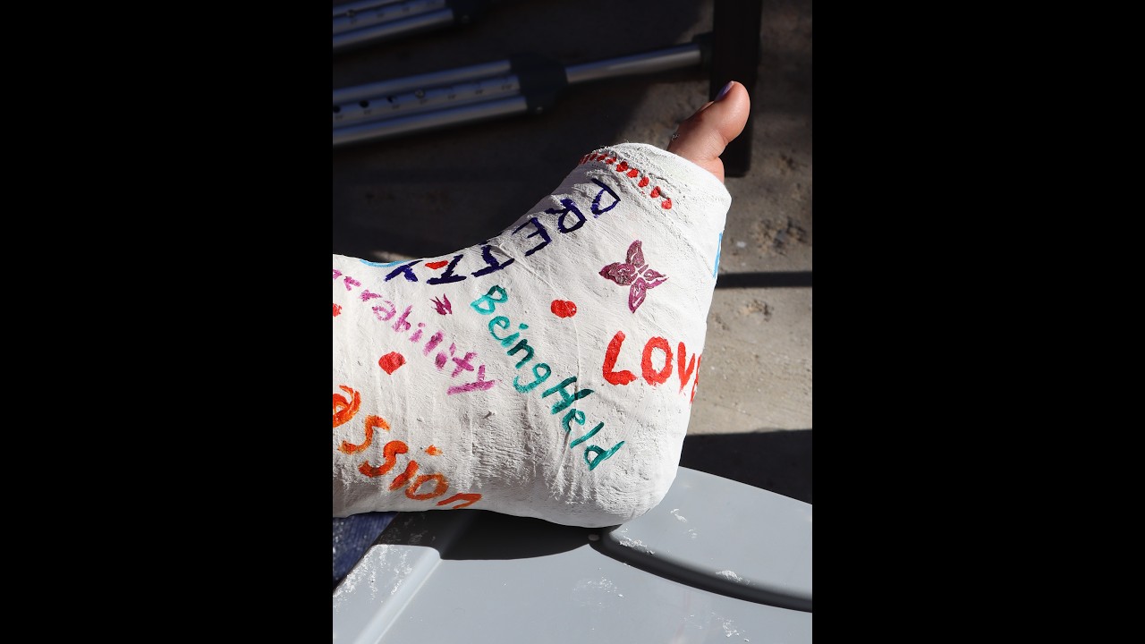 Short Leg Cast – Process-Based Art Project | Plaster Cast Experience