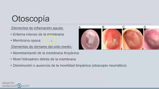 IRA alta. Segunda parte