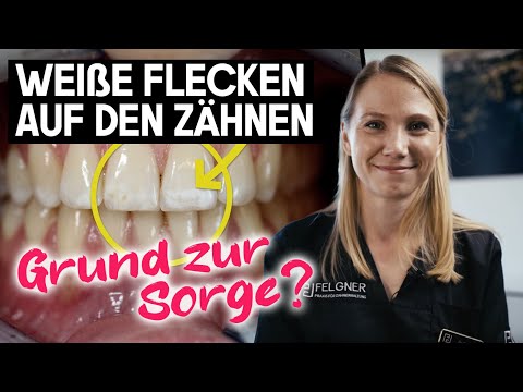Was sind weiße Flecken auf deinen Zähnen und warum sind sie da?