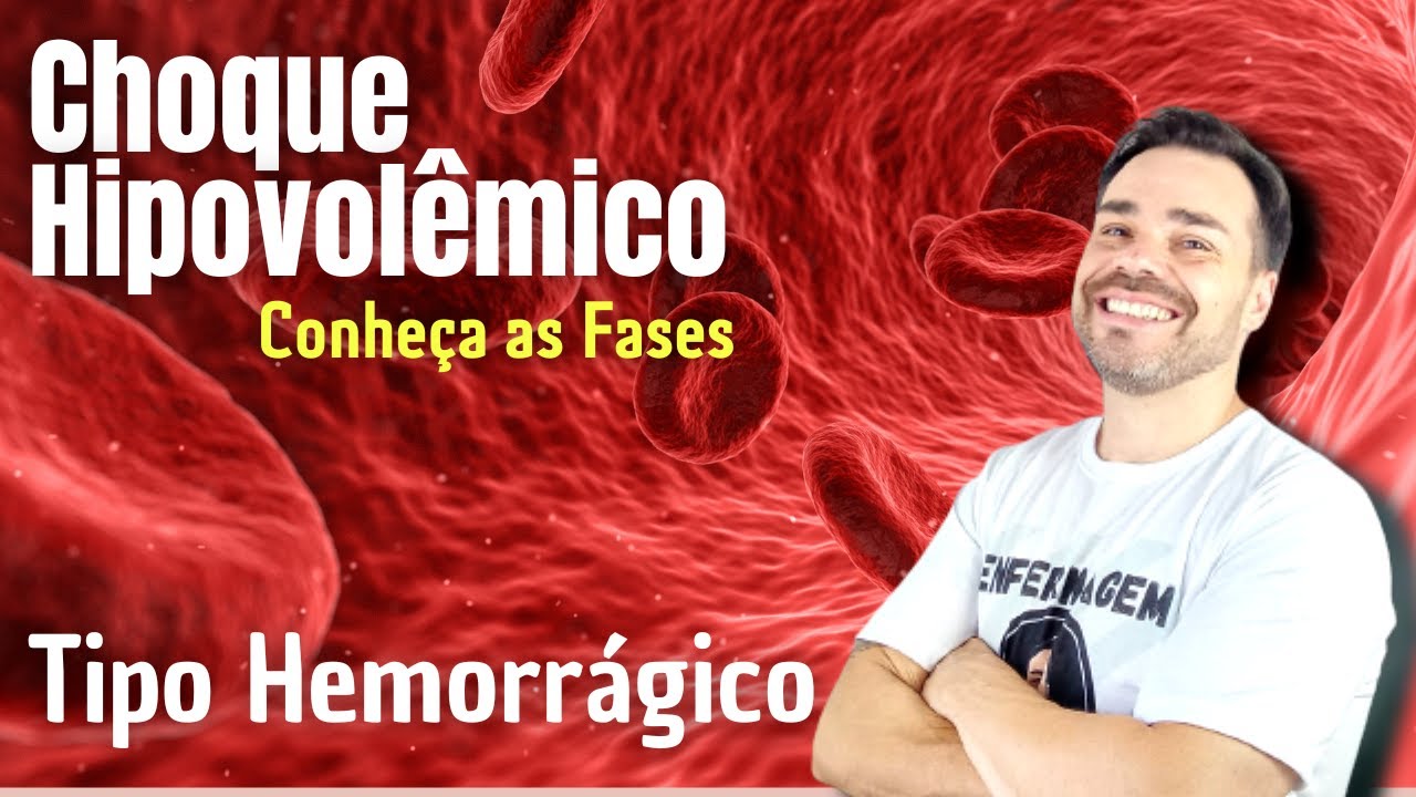 CHOQUE HIPOVOLÊMICO - Tipo HEMORRÁGICO Veja como o corpo responde nesta situação.