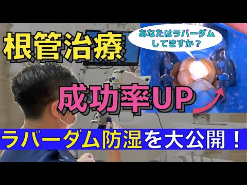 生命歯学科 根管治療の成功率を上げるカギはラバーダムにある？！根管治療におけるラバーダムの重要性について🦷あなたはラバーダムを使ってもらっていますか？成功率や使用率について詳しく解説します