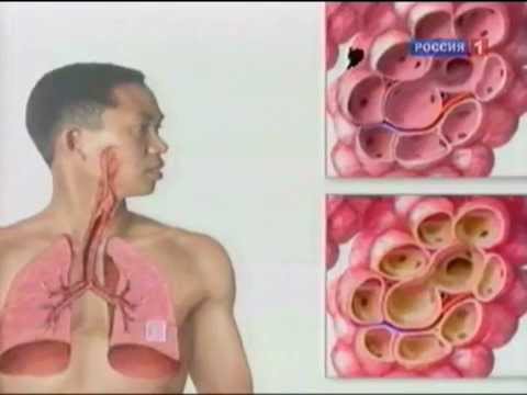 Боли справа в спине отдающие в живот у мужчин Анализы по суставам