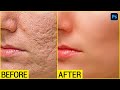 Face Ko Smooth Kaise Kare High End Skin Retouching Photoshop Tutorial In Hindi SABKE SAB