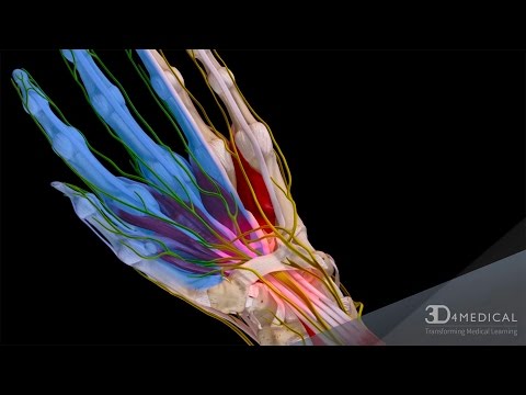 Open Carpal Tunnel Release