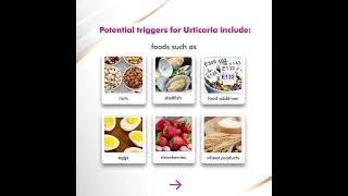 Get Urticaria cured | Dermatologist | Dr. Khyati Patel