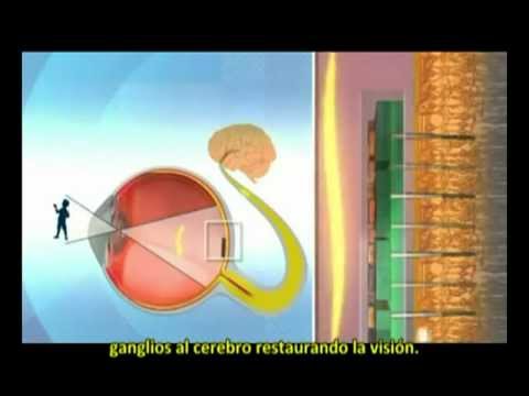 Israel: Una Nano Retina artificial para recuperar la visión