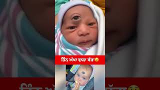 three eyes baby 😲😲 #shortvideo #youtube