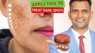 Get Rid Of Pigmentation, melasma and Dark Spots on Face | Magical Skin Care Mask