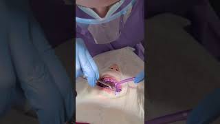 Video 12