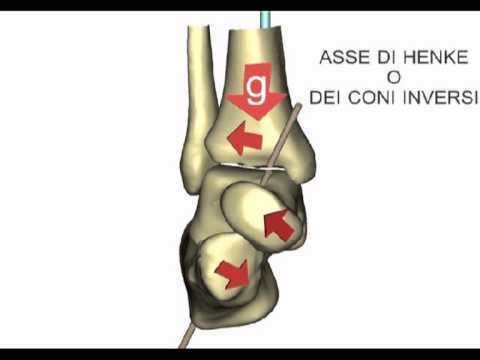 Gomito a trazione come trattare Acido nicotinico come intramuscolare lancinante allosteocondrosi