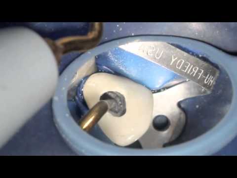 Crown Access, Post Removal, Calcified Canal Technique