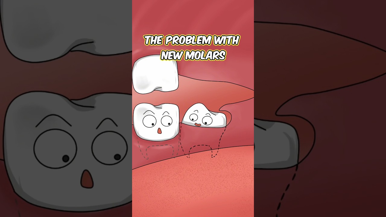 The Problem With New Molars