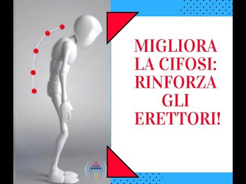 Sovratensione muscoli del collo Mal di testa Qual è linfiammazione dei legamenti dellarticolazione della spalla