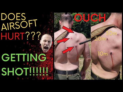Does Airsoft Hurt? | Getting SHOT at 10m, 20m and 30m.