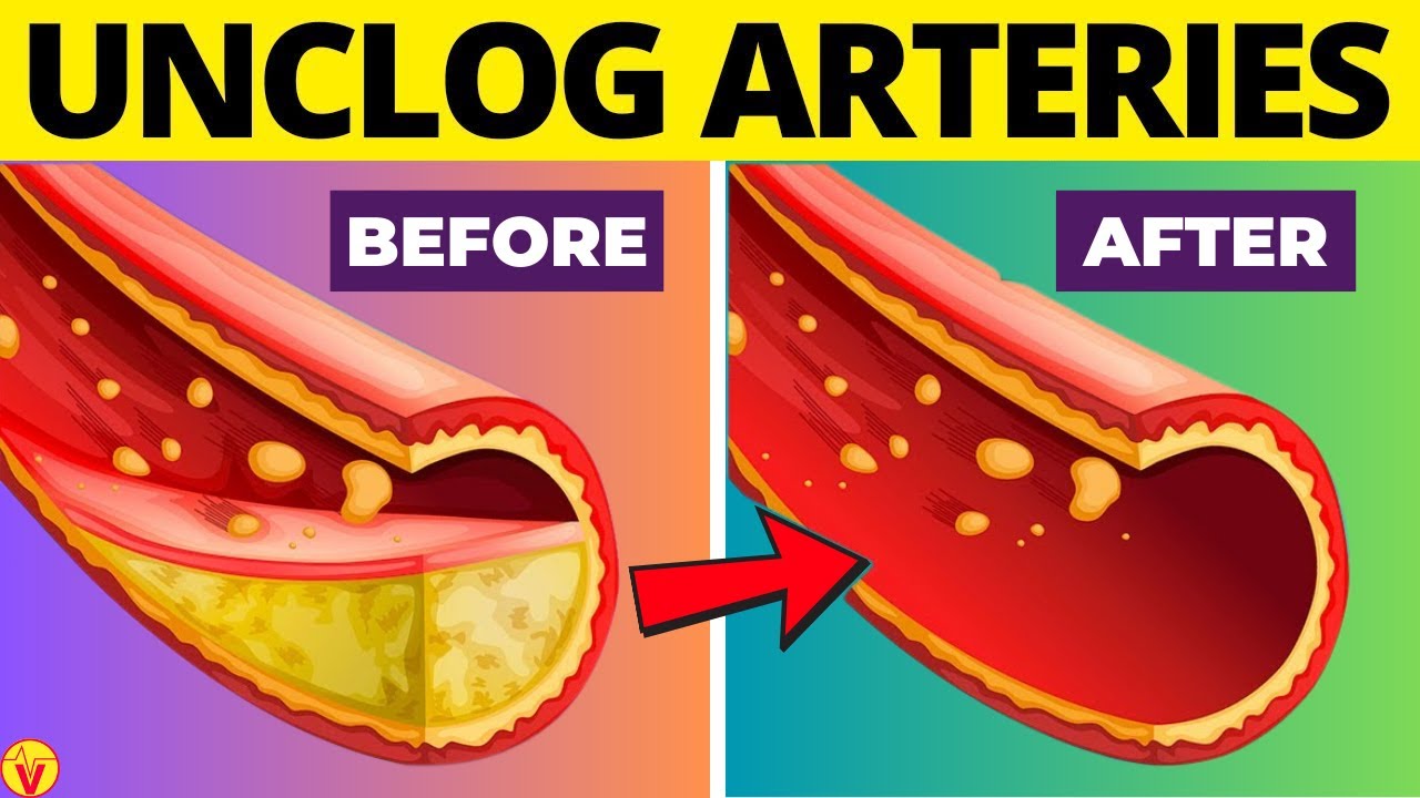 12 Drinks to UNCLOG ARTERIES And Prevent HEART ATTACK | VisitJoy