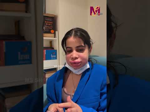 Urfi Javed New Face , Doesn’t Understand Beauty ! 💅🏻| #urfijaved  #viral #bollywood #msshorts