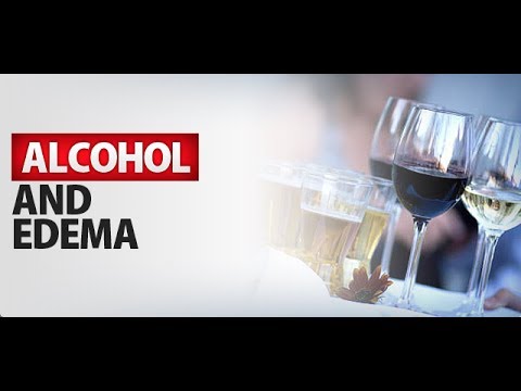 download lagu mp3 mp4 Why Do My Feet Swell When I Drink Alcohol, download lagu Why Do My Feet Swell When I Drink Alcohol gratis, unduh video klip Why Do My Feet Swell When I Drink Alcohol