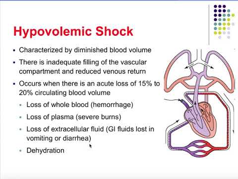 Pathophysiology Ch 20 Shock