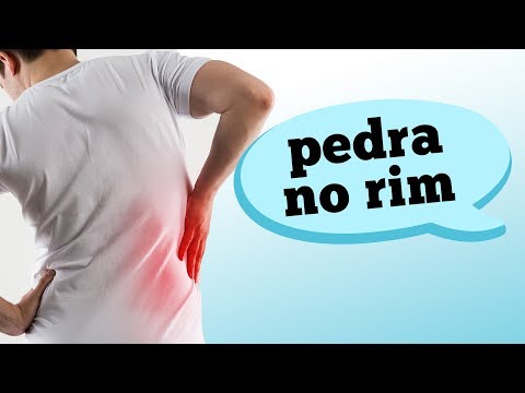 Dor Nas Costas Pode Ser Pedra Nos Rins