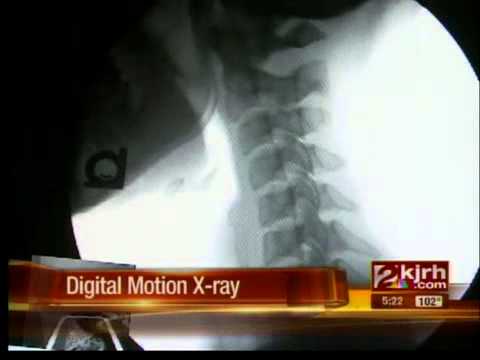 Digital motion X-ray