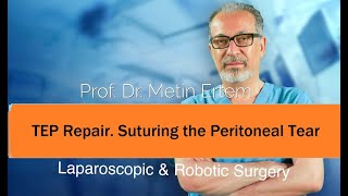 Miniaturka - TEP Repair. Suturing the Peritoneal Tear. Metin Ertem MD.FACS