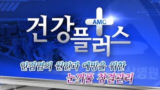 눈꺼풀에 여드름이 났다고요? - 안검염의 원인과 예방을 위한 눈꺼풀 청결관리 미리보기