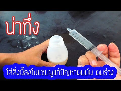 ดินเหนียวสีขาวจากโรคสะเก็ดเงิน Palmar-ฝ่าเท้าวินิจฉัยโรคสะเก็ดเงินค่า