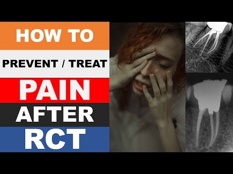 Management Of Pain After RCT