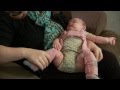 Baby Hip Instability and Dysplasia - Mayo Clinic