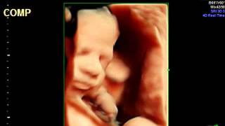 4D Ultrasound Video of Baby Before Birth