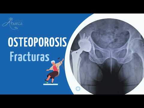 Video educativo sobre osteoporosis