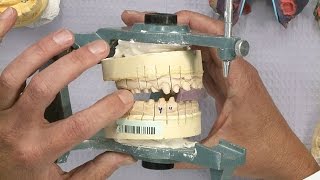 Chairside Live Episode 136: Defend the Dimension … The Vertical Dimension!