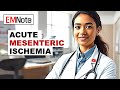 acute mesenteric ischemia