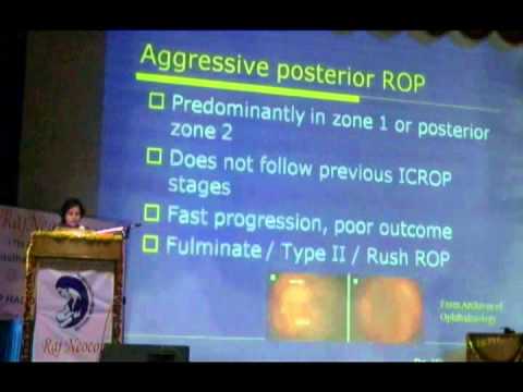 Let's Spread Awareness About Retinopathy Of Prematurity In Children