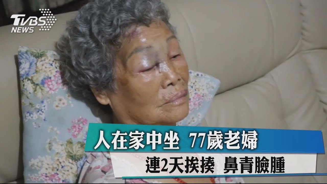 人在家中坐 77歲老婦連2天挨揍鼻青臉腫