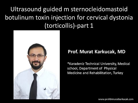 Ultrasound guided m sternocleidomastoid botulinum toxin injection for cervical dystonia  part 1