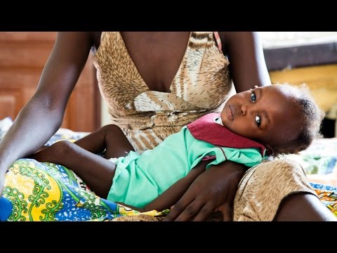 Click to Watch the Over 20 million people facing starvation - and we should care! video