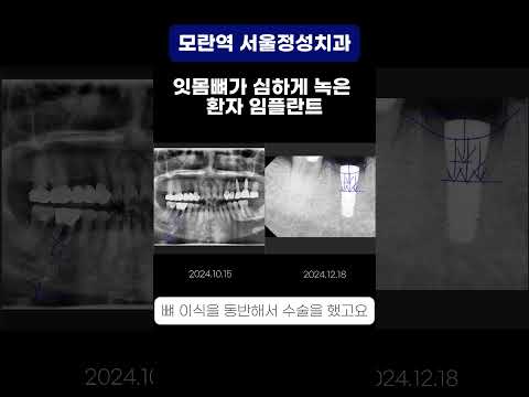 땡큐성형외과 Clips