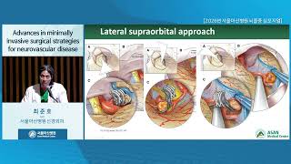 2026년 서울아산병원 뇌졸중 심포지엄  : Advances in minimally invasive surgical strategies for neurovascular disease 미리보기